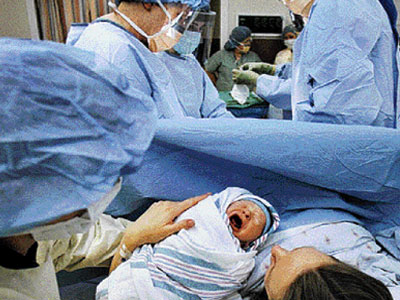 Γονιμότητα: Μυωπία και καισαρική τομή – Ένας ακόμη μύθος